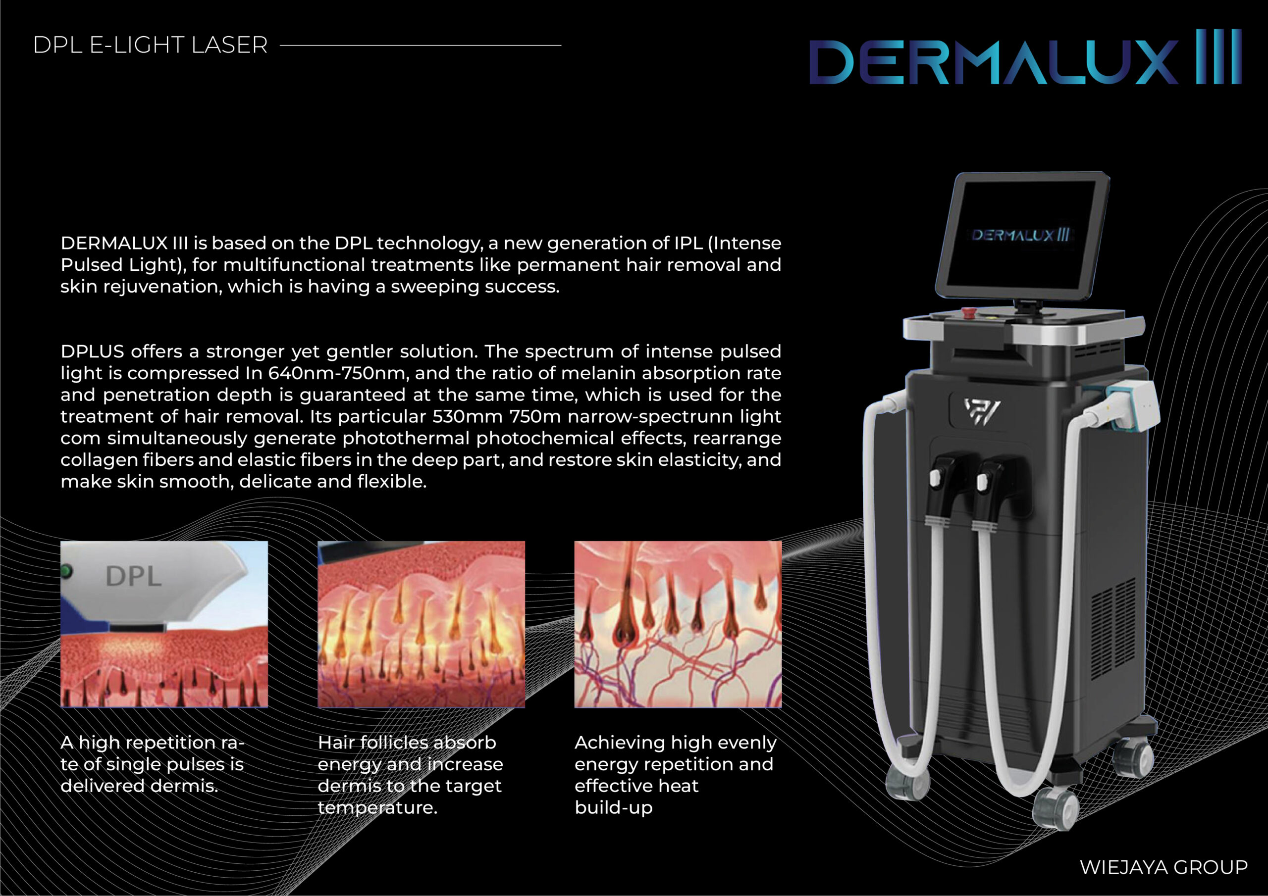 Dermalux menggunakan teknologi Dynamic Pulse Light, yang merupakan pengembangan teknologi dari IPL