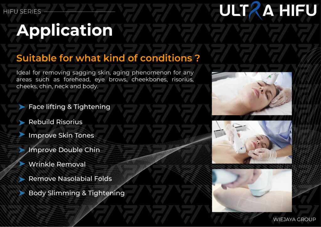 Ultra HIFU Adalah High-intensity Focused Ultrasound (HIFU) dengan teknologi non-invasif yang Ideal untuk menghilangkan kulit kendur serta mengencangkan kulit dan tanda penuaan untuk semua area seperti dahi, alis mata, tulang pipi, risorius, pipi, dagu, leher dan tubuh, Gelombang ultrasound yang lebih stabil merangsang produksi kolagen dan elastin, untuk hasil yang alami tanpa operasi.