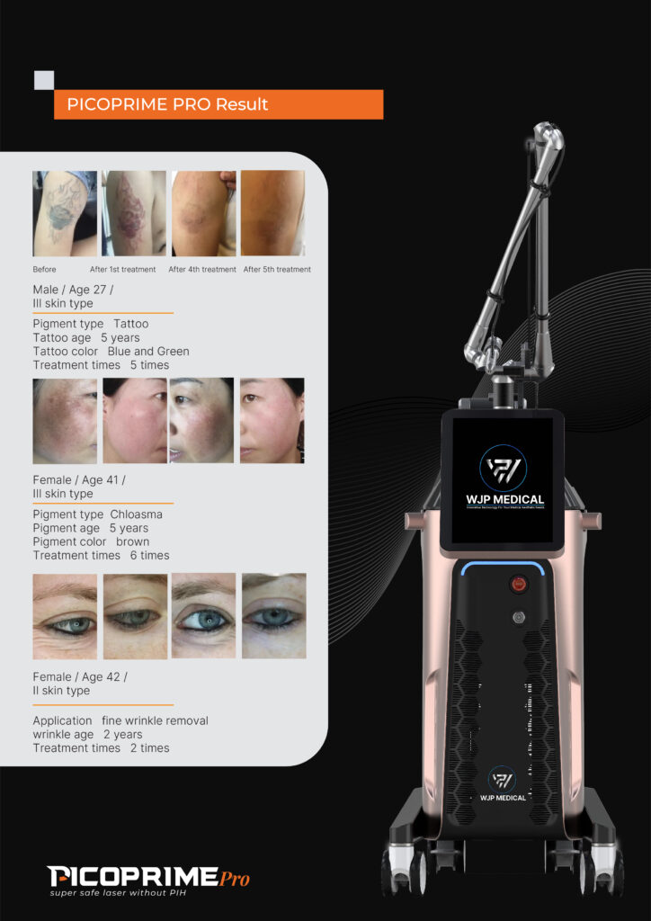 PICO PRIME PRO lASER UNTUK HAPUS TATTO