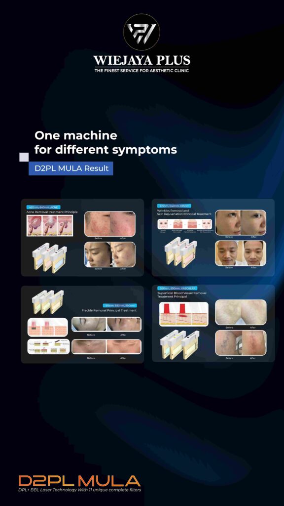 Alat Kecantikan untuk Klinik: D2PL MULA Solusi Modern dari WiejayaPlus